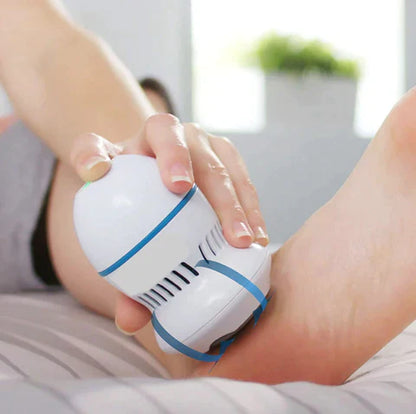 Aurahaus Vacuum Callus Remover