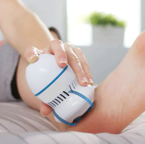 Aurahaus Vacuum Callus Remover